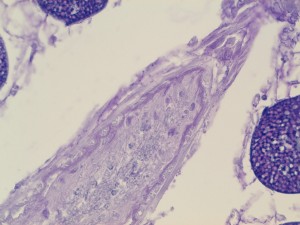 Sezione di nematode di StratoSpera 2. Ingrandimento 25X, colorazione pas. Foto di Luigi Caliendo.